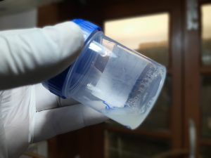 DIAGNÓSTICO Y CARACTERÍSTICAS DEL LÍQUIDO SEMINAL HUMANO